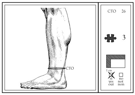 POLAINA-CORTA.jpg